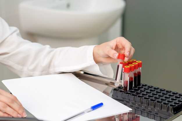 Benefits of Drug Testing for Patient Safety:
