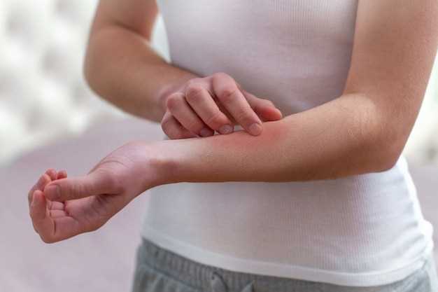 Understanding Itching Symptoms