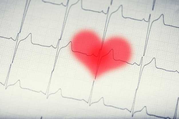 The link to sudden cardiac death
