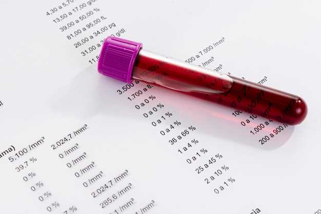 Estimation of escitalopram oxalate